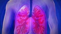 Small Cell Lung Cancer Treatment