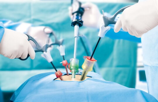 laparoscopy