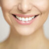 Benefits Of Teeth Whitening: Make Your Smile Beautiful
