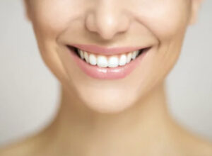 Benefits Of Teeth Whitening: Make Your Smile Beautiful