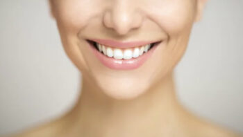 Benefits Of Teeth Whitening: Make Your Smile Beautiful
