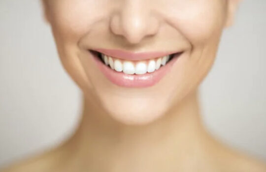 Benefits Of Teeth Whitening: Make Your Smile Beautiful