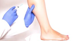 What You Need to Know About Calf Reduction Surgery