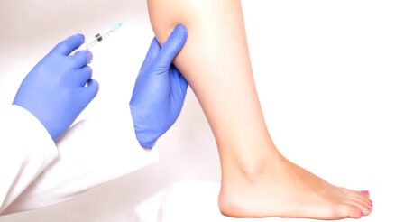 What You Need to Know About Calf Reduction Surgery