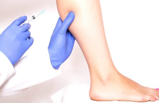 What You Need to Know About Calf Reduction Surgery