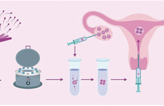 The Benefits of Delayed Frozen Embryo Transfer