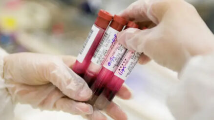 The mystery behind the private blood tests