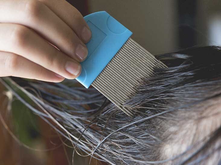 Types, Causes, Diagnosis and Treatment of Head Lice