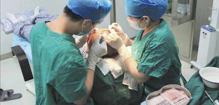 The Best Clinic for a Hair Transplant in Istanbul