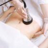 What's ultrasonic cavitation treatment?