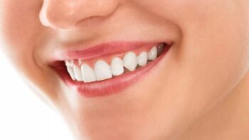 How Restoration and Fillings Can Transform Your Smile