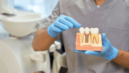 Age is Just a Number: Dental Implants for the Elderly