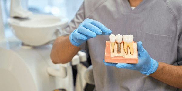 Age is Just a Number: Dental Implants for the Elderly